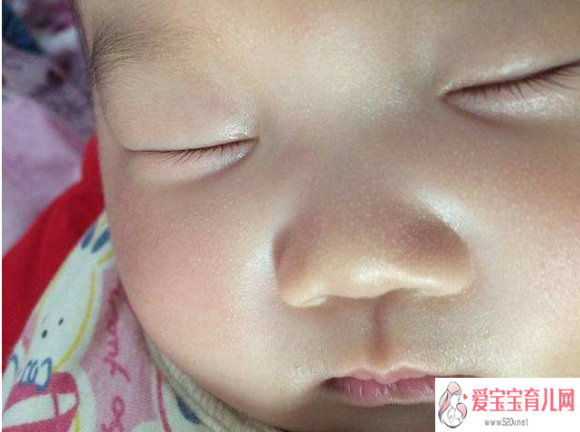 北京地下供卵机构~新生儿鼻子上的白点是什么新生儿鼻子上的白点怎么处理