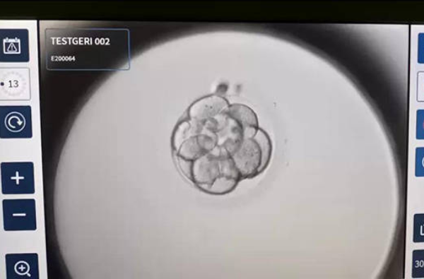 胚胎配成率低的原因是什么